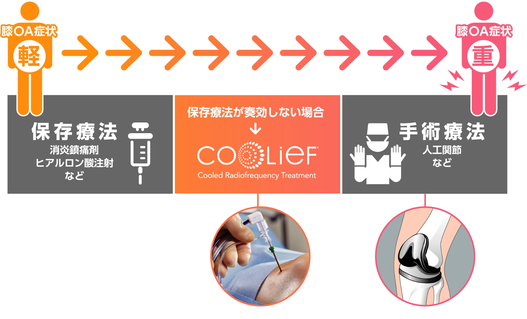 Cooliefの主な適応症